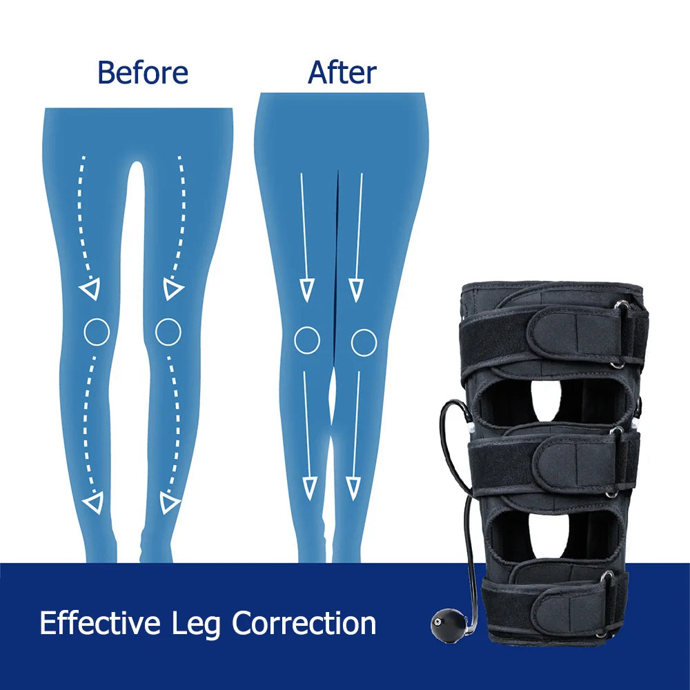 O X Legs Orthotic Corrector for Adults Leg Straightening Correction Physical Traction Leg Straightening Beauty Legs Shape Brace